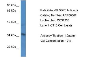 Western Blotting (WB) image for anti-SH3-Domain Binding Protein 5 (SH3BP5) (N-Term) antibody (ABIN2788423) (SH3BP5 anticorps  (N-Term))