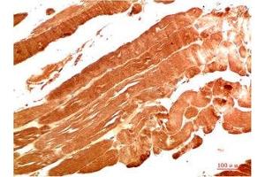Immunohistochemical analysis of paraffin-embedded Human Skeletal Muscle Tissue using NBR1 Mouse mAb diluted at 1:200. (NBR1 anticorps)