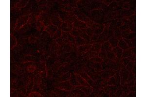 E-cadherin for IHC in human HepG2,Provided by Tianjin University