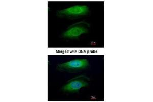 ICC/IF Image Immunofluorescence analysis of paraformaldehyde-fixed HeLa, using RICTOR, antibody at 1:200 dilution.