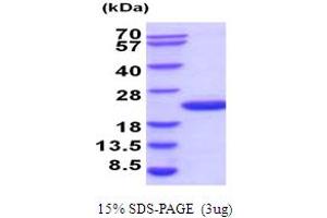 SDS-PAGE (SDS) image for Ubiquitin-Conjugating Enzyme E2G 2 (UBE2G2) (AA 1-165) protein (His tag) (ABIN5854278) (UBE2G2 Protein (AA 1-165) (His tag))