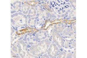 Immunohistochemistry analysis of paraffin-embedded mouse kidney using,SPTBN2 (ABIN7075698) at dilution of 1: 2000