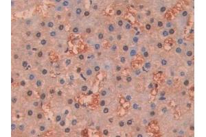 Detection of DDT in Human Liver Tissue using Polyclonal Antibody to D-Dopachrome Tautomerase (DDT)