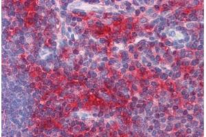 Human Thymus: Formalin-Fixed, Paraffin-Embedded (FFPE)