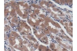 Detection of UCP2 in Human Stomach Tissue using Monoclonal Antibody to Mitochondrial Uncoupling Protein 2 (UCP2)