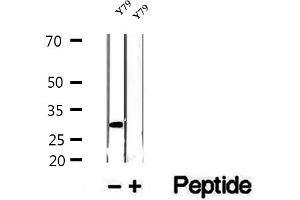 Western blot analysis of extracts of Y79 cells, using ETFA antibody. (ETFA anticorps  (Internal Region))