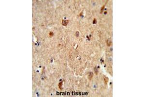 Formalin-fixed and paraffin-embedded human brain tissue reacted with CES7 Antibody (Center), which was peroxidase-conjugated to the secondary antibody, followed by DAB staining.