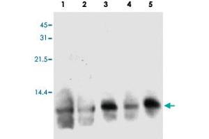Western blot analysis of human S100A3 in hair extracts from 3 individual female. (S100A3 anticorps)