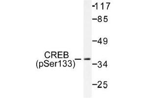 Image no. 1 for anti-cAMP Responsive Element Binding Protein 1 (CREB1) (pSer133) antibody (ABIN318001) (CREB1 anticorps  (pSer133))