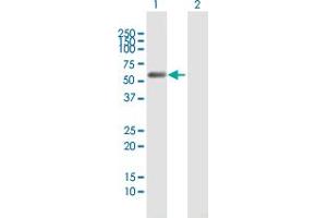 Western Blot analysis of C9orf156 expression in transfected 293T cell line by C9orf156 MaxPab polyclonal antibody. (C9orf156 anticorps  (AA 1-441))