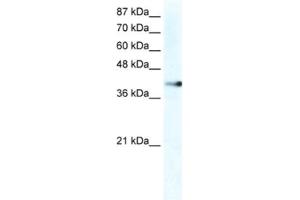 Western Blotting (WB) image for anti-Zinc Finger Protein 556 (ZNF556) antibody (ABIN2461276) (ZNF556 anticorps)