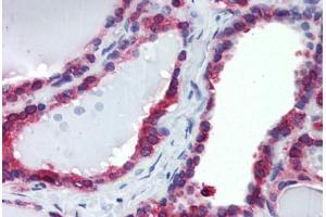 Thyroid, Human: Formalin-Fixed, Paraffin-Embedded (FFPE)