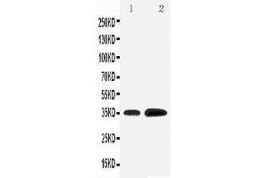Anti-KLF3 antibody, Western blotting Lane 1: Rat Testis Tissue Lysate Lane 2: HELA Cell Lysate