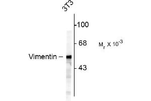 Mixed neuron/glial cultures stained with anti-Vimentin (green) and rabbit anti-GFAP antibody (620-GFAP) (red). (Vimentin anticorps)