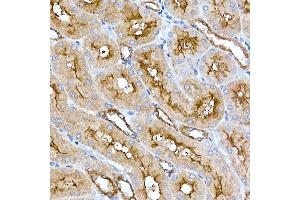 Immunohistochemistry of paraffin-embedded rat kidney using Folate Binding Protein(FBP) / FOLR1 Rabbit mAb (ABIN7267223) at dilution of 1:100 (40x lens). (FOLR1 anticorps)