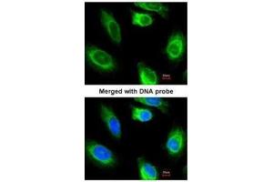 ICC/IF Image Immunofluorescence analysis of paraformaldehyde-fixed HeLa, using glycerol kinase 2, antibody at 1:200 dilution.