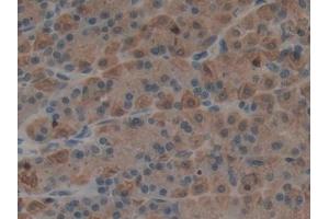 DAB staining on IHC-P; Samples: Rat Stomach Tissue (Epiregulin anticorps  (AA 1-162))