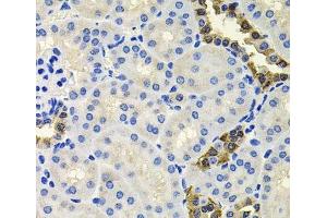 Immunohistochemistry of paraffin-embedded Mouse kidney using CALB2 Polyclonal Antibody at dilution of 1:100 (40x lens). (Calretinin anticorps)