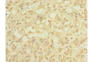 Immunohistochemistry of paraffin-embedded human adrenal gland tissue using ABIN7150185 at dilution of 1: 100 (MCM9 anticorps  (AA 1-391))