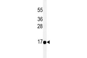 THEM2 antibody western blot analysis in HeLa lysate.