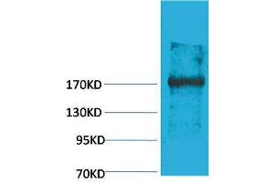 Western Blotting (WB) image for anti-Ectopic P-Granules Autophagy Protein 5 Homolog (EPG5) antibody (ABIN3181525) (EPG5 anticorps)