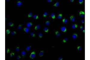 Immunofluorescence staining of A549 cells with ABIN7147174 at 1:50, counter-stained with DAPI.