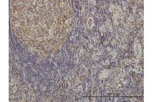 Image no. 2 for anti-Cyclin-Dependent Kinase-Like 4 (CDKL4) (AA 196-295) antibody (ABIN599344) (CDKL4 anticorps  (AA 196-295))