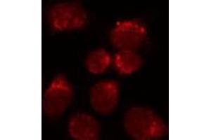 ABIN6272248 staining HuvEc by IF/ICC. (NR2F2 anticorps  (N-Term))
