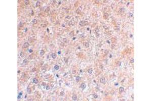 Immunohistochemical staining of mouse liver using TP53INP1 polyclonal antibody  at 2 ug/mL . (TP53INP1 anticorps  (C-Term))