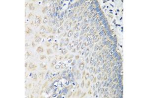 Immunohistochemistry of paraffin-embedded human esophagus using OXCT1 antibody at dilution of 1:100 (40x lens). (OXCT1 anticorps)