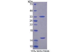 SDS-PAGE analysis of Human PGM3 Protein. (Phosphoglucomutase 3 Protein (PGM3))