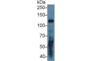 Detection of LAMC2 in Human A431 cell lysate using Polyclonal Antibody to Laminin Gamma 2 (LAMC2) (LAMC2 anticorps  (AA 28-196))