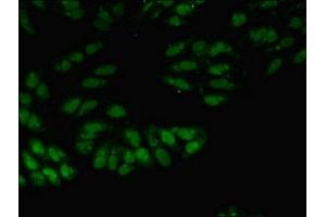 Immunofluorescent analysis of Hela cells using ABIN7174131 at dilution of 1:100 and Alexa Fluor 488-congugated AffiniPure Goat Anti-Rabbit IgG(H+L)