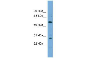 WB Suggested Anti-ULK3 Antibody Titration: 0. (ULK3 anticorps  (Middle Region))