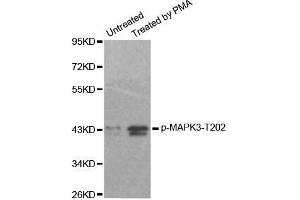 Western blot analysis of extracts from 293 cells, using Phospho-MAPK3-T202 antibody. (ERK1 anticorps  (pThr185))