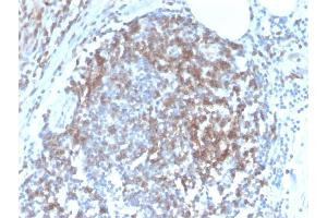 Formalin-fixed, paraffin-embedded human Tonsil stained with CD6 Rabbit Recombinant Monoclonal Antibody (C6/2884R). (Recombinant CD6 anticorps)