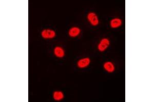 Immunofluorescent analysis of SP3/4 staining in HeLa cells. (Sp3/4 anticorps  (C-Term))