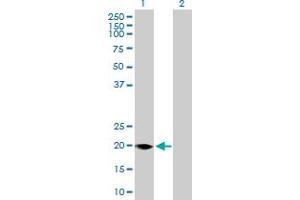 Western Blot analysis of FMO9P expression in transfected 293T cell line by FMO9P MaxPab polyclonal antibody. (FMO9P anticorps  (AA 1-160))