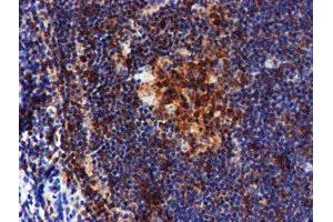 Image no. 5 for anti-LIM Domain Kinase 1 (LIMK1) antibody (ABIN1499147)