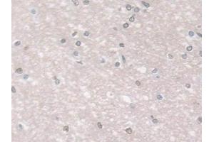 Detection of GPX3 in Human Cerebrum Tissue using Polyclonal Antibody to Glutathione Peroxidase 3, Plasma (GPX3)