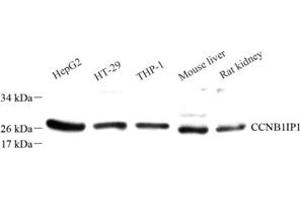 Western blot analysis of Ccnb1ip1 (ABIN7073614) at dilution of 1: 50 (CCNB1IP1 anticorps)