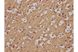 Immunohistochemistry of paraffin-embedded human brain tissue using ABIN7144489 at dilution of 1:200