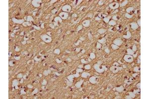 Immunohistochemistry of paraffin-embedded human brain tissue using ABIN7144489 at dilution of 1:200 (APP anticorps)