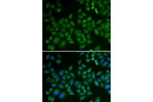 Immunofluorescence analysis of HeLa cells using SMPD1 antibody.