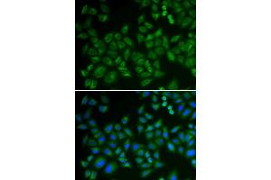 Immunofluorescence analysis of HeLa cells using SMPD1 antibody. (SMPD1 anticorps  (AA 70-340))