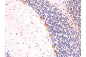 Formalin-fixed, paraffin-embedded Rat Brain stained with ARF1 Mouse Monoclonal Antibody (ARF1/2117).