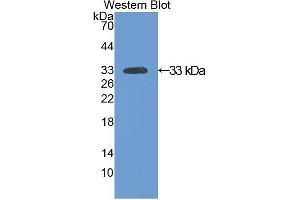 Western blot analysis of recombinant Rat SIRT2. (SIRT2 anticorps  (AA 28-303))
