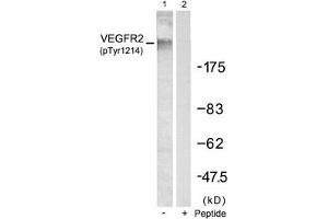 Western blot analysis of extracts from SKOV3 cells using VEGFR2(Phospho-Tyr1214) Antibody(Lane 1) and the same antibody preincubated with blocking peptide(Lane2). (VEGFR2/CD309 anticorps  (pTyr1214))