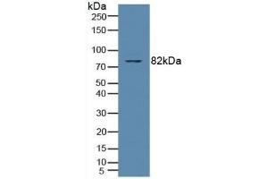 Detection of PKCq in Human Jurkat Cells using Polyclonal Antibody to Protein Kinase C Theta (PKCq) (PKC theta anticorps  (AA 380-634))