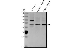 Western blot analysis of ETV4 using anti-ETV4 antibody (AZQ9PUQ1).